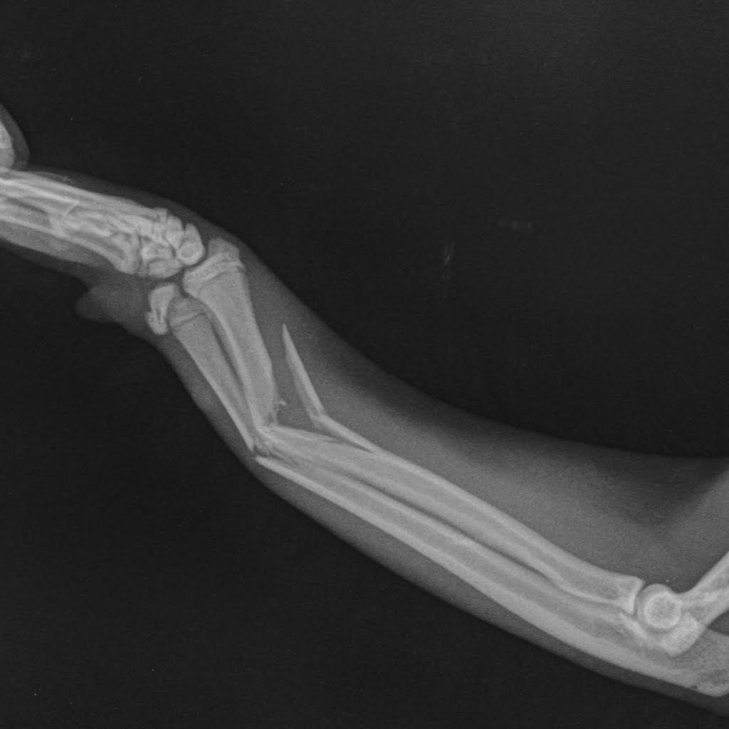 рентген лапы кошки